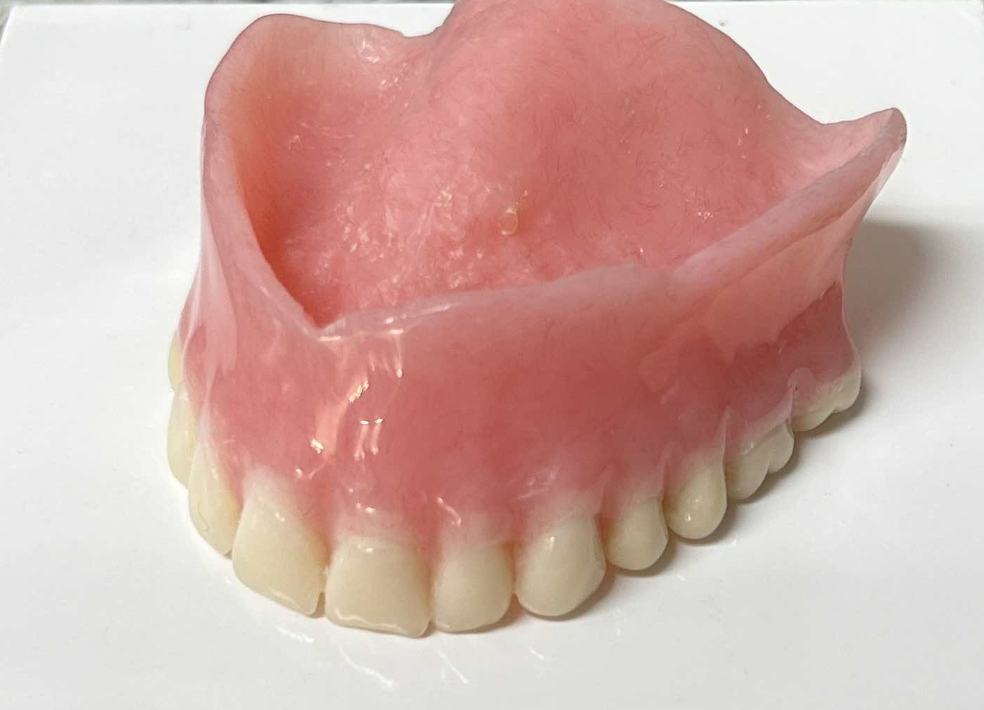 aba-dentures-image-2